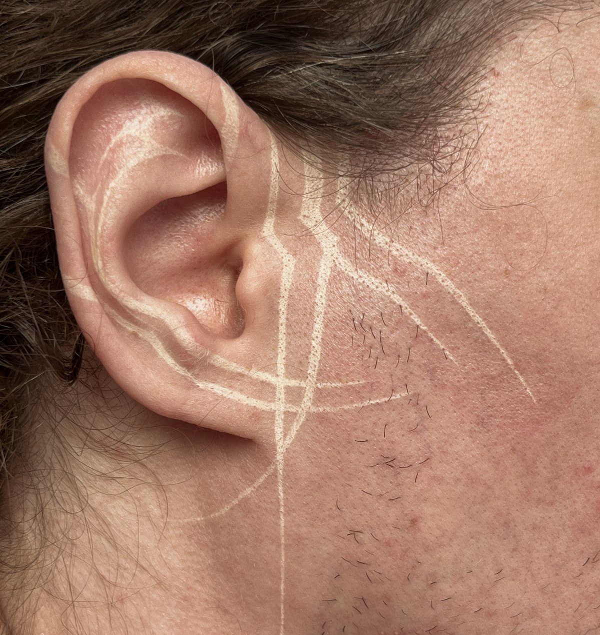 White ink tattoo with abstract lines on a person's ear and cheek.